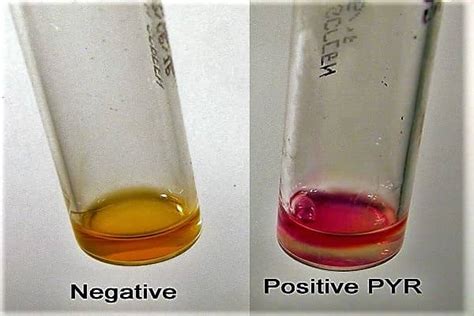 streptococcus pyogenes biochemical test